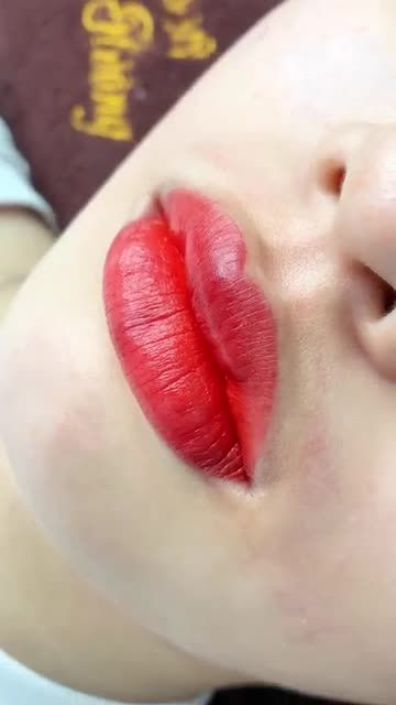 Kết quả phun môi sau 40 phút