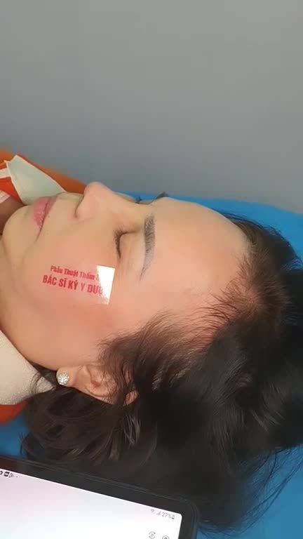 Cải thiện ngay tình trạng: - Mũi thấp tẹt, đầu mũi hếch kém phong thủy