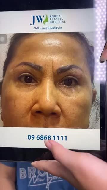 BẤT NGỜ CHƯA! Hô biến Quý cô U70 HỒI XUÂN 20 TUỔI với TREO CHÂN MÀY NỘI SOI 4X