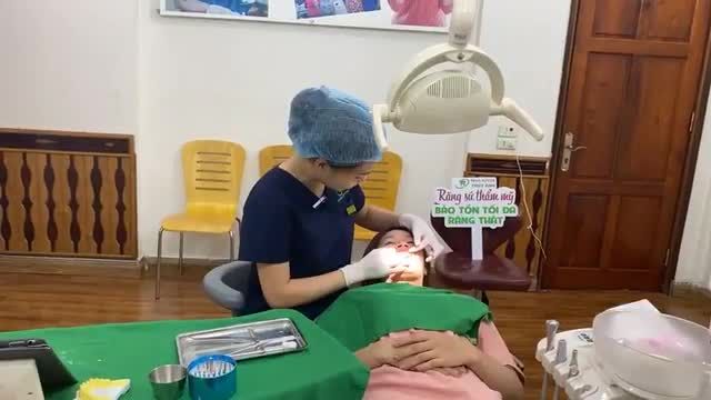 Lắp răng sứ điều trị sâu kẽ
