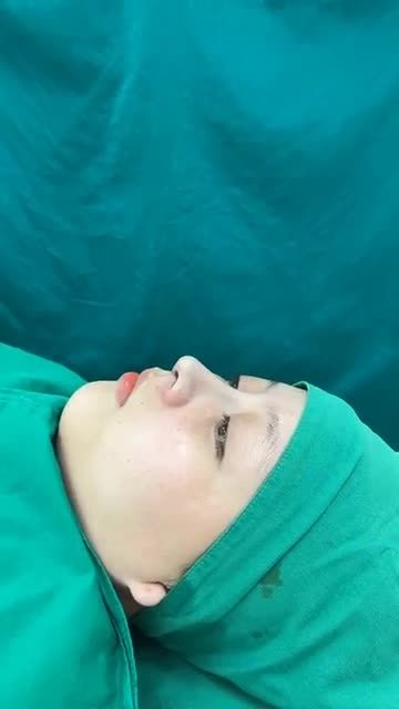 Case mũi cấu trúc vừa hoàn thành