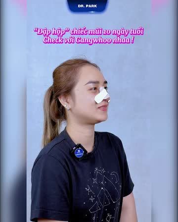 NÂNG MŨI - MUỐN MŨI ĐẸP SAU 10 NGÀY GHI NHỚ NHỮNG ĐIỀU SAU NHÉ!