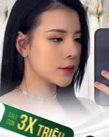 NÂNG MŨI CẤU TRÚC CHỈ CÒN 3 TR - CHO DÁNG MŨI ĐẸP TOÀN DIỆN