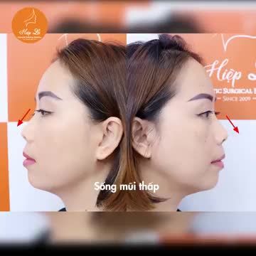 "Quyết định đúng lúc, lựa chọn đúng nơi” Tự tin tỏa sáng thôi chị em ơi!