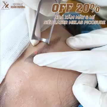 CHỈ 15 PHÚT XÓA SẠCH MỰC XĂM MÀY - MÍ VỚI CÔNG NGHỆ MELAS PICOSURE