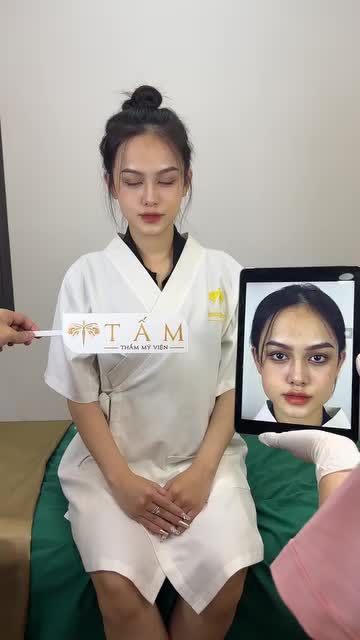 "Mặt em đã nhỏ hơn, hài hòa hơn và các đường nét cũng rõ nét hơn. Đặc biệt là nhìn rất tự nhiên" - Bạn khách chia sẻ