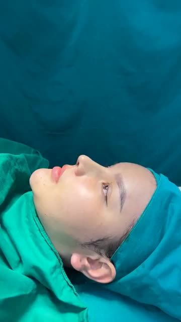 Case mũi cấu trúc vừa hoàn thành