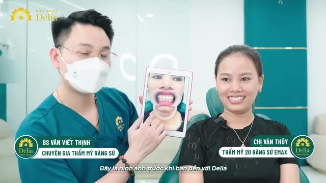 Trước khi đến với nha khoa Delia, chị Văn Thuỷ thường cảm thấy thiếu tự tin