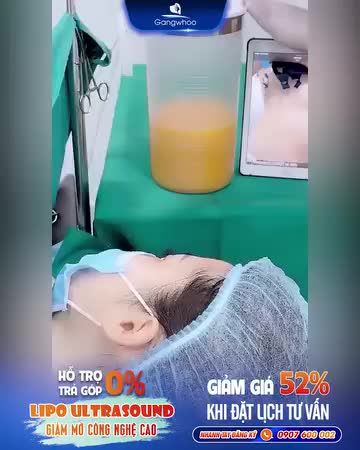 LIPO ULTRASOUND - KHÔNG HẾT MỠ LÀ HOÀN TIỀN