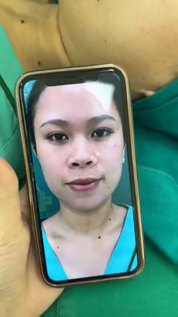 Case mũi cấu trúc vừa hoàn thành