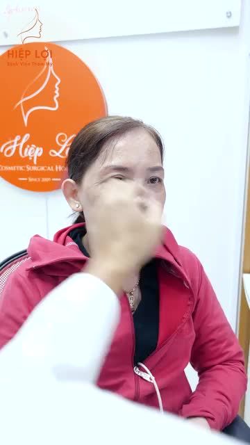 Bác sĩ Lợi tư vấn cho khách hàng tình trạng mí mắt và cách khắc phục hiệu quả, để đạt được độ tự nhiên so với độ tuổi của chị khách hàng.