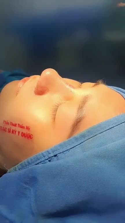 Bạn khách này trên khuôn mặt đã có nét sẵn. Tuy nhiên, chiếc mũi của bạn ấy lại không được nổi bật.