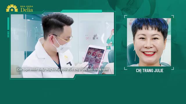 Chị Trang Julie luôn mong muốn làm thẩm mỹ răng sứ để khắc phục các tình trạng răng ố vàng, hình thể ngắn, sứt mẻ