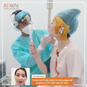 Tái tạo dáng mũi cho tư vấn viên 9X đến từ Bến Tre đã từng nâng mũi bọc sụn.