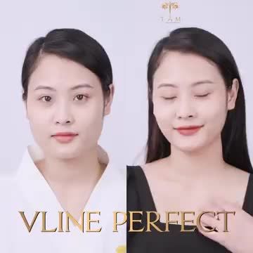 “Bùng n.ổ visual” nhờ THON GỌN HÀM VLINE PERFECT tại Tấm