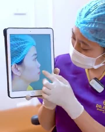 Mũi thấp tẹt được Dr.Hải Lê chỉnh hình thành công sau 10 ngày trông sẽ như thế nào? Theo dõi ngay