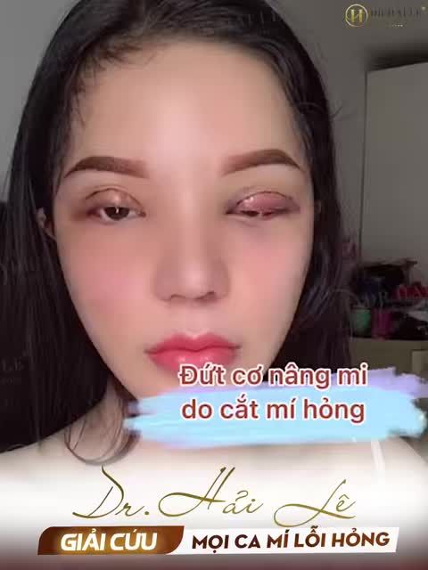 Đây là lý do mí bạn lỗi hỏng ở đâu không nhận Dr.Hải Lê nhận sửa thành công cho bạn!