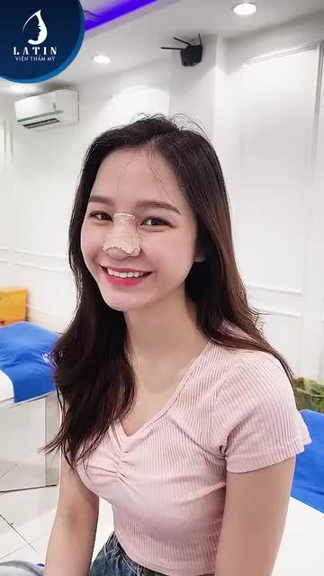 Em gái tái khám mũi bán cấu trúc 10 ngày