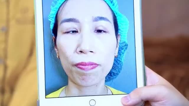 Bạn tự ti với đôi mắt của mình, bạn tìm đến nhiều bác sĩ nhưng chỉ nhận được cái lắc đầu... Bạn đừng quá lo lắng Dr.Hải Lê đã có giải pháp khắc phục