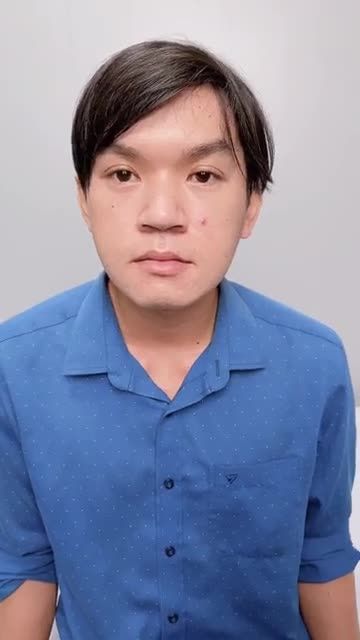 GƯƠNG MẶT ĐIỂN TRAI HÀI HÒA CÂN ĐỐI HƠN VỚI DỊCH VỤ TRƯỢT HÀM TẠI BVTM GANGWHOO