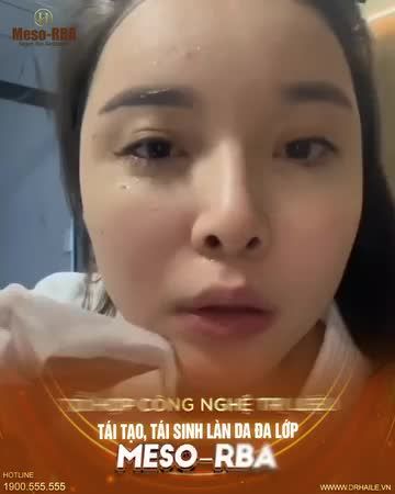 Mỗi lần bạn soi gương, nỗi lo trong lòng lại trỗi dậy