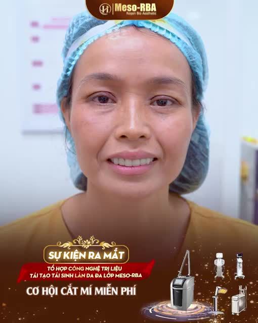 CẮT MÍ MIỄN PHÍ TRONG TẦM TAY NGAY TẠI SỰ KIỆN THẨM MỸ SONG HÀNH LỚN NHẤT MIỀN BẮC TRONG 1 THẬP KỶ