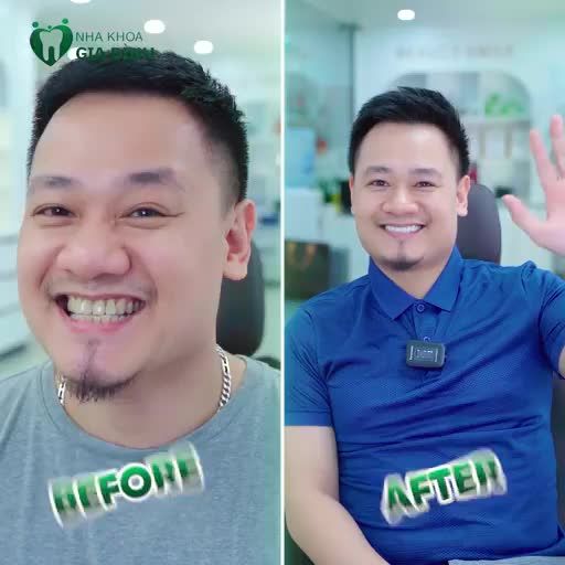 NHẠC SĨ NGUYỄN ĐỨC CƯỜNG CHIA CẢM NHẬN SAU KHI SỞ HỮU ĐƯỢC HÀM RĂNG ĐÚNG Ý MÌNH TẠI NHA KHOA GIA ĐÌNH