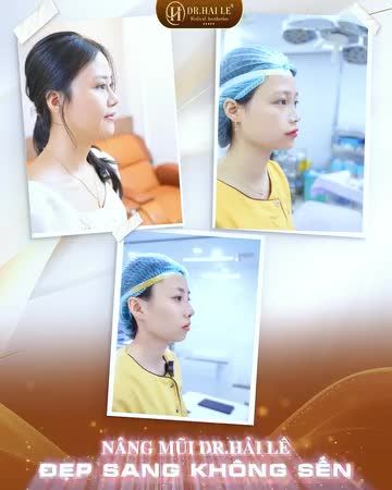  Mũi bền đẹp, dẹp tự ti - Để lại SĐT nhận tư vấn miễn phí về tình trạng mũi của bạn!