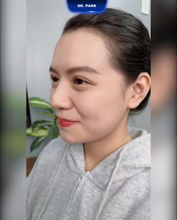 NÊN CHỌN CƠ SỞ NÂNG MŨI NHƯ THẾ NÀO?