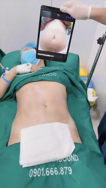VÌ SAO NÊN LOẠI BỎ MỠ CÀNG SỚM CÀNG TỐT?