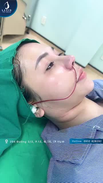 Bạn nào dáng mũi to bè, mũi gồ ghề thì xem ngay video này!