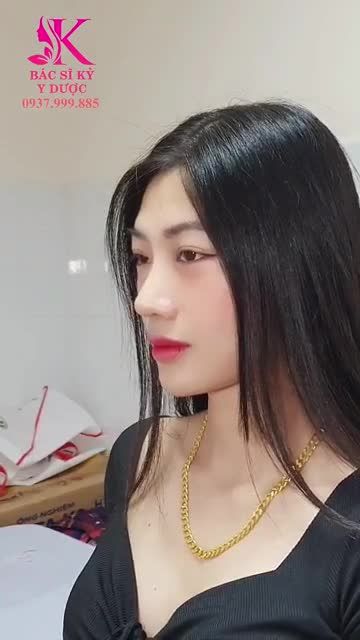 “SIÊU PHẨM” NÂNG MŨI ALINE LÀ ĐÂY