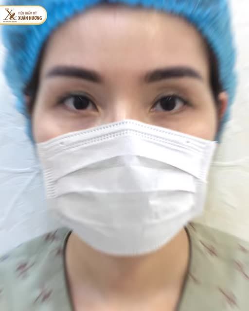 TẠO HÌNH THÁI DƯƠNG QUAN TRỌNG NHƯ THẾ NÀO?
