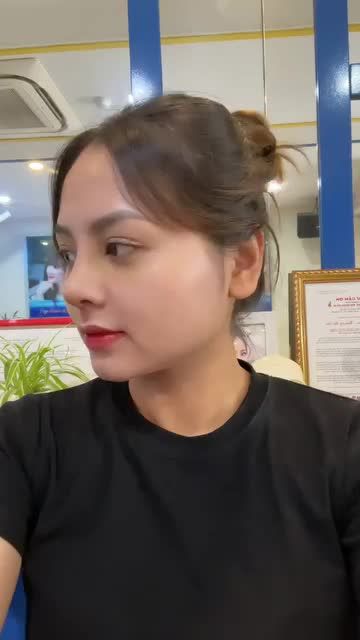 Hành trình 30 ngày nâng mũi của nàng tiktoker Trang Tấm