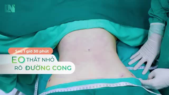 Như thế nào là đường eo thắt đáy?
