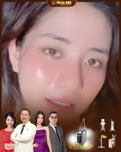 Bạn muốn sở hữu làn da đẹp như cô ấy? -Tham gia ngay sự kiện cực HOT của Dr.Hải Lê, thực hiện tổ hợp công nghệ trị liệu Meso-RBA hoàn toàn miễn phí!