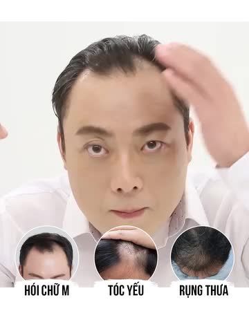 TÓC MỌC TUA TỦA GIẢM NGAY 50%