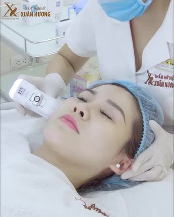 60 phút thực hiện nâng cơ cùng VGold Hifu, mọi dấu hiệu của làn da lão hóa đều được xóa bỏ