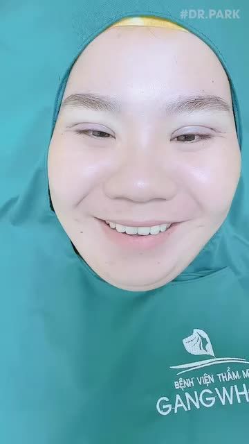 TẠI SAO NÊN CHỌN TÌM ĐẾN GANGWHOO ĐỂ THỰC HIỆN BẤM MÍ VĨNH VIỄN?