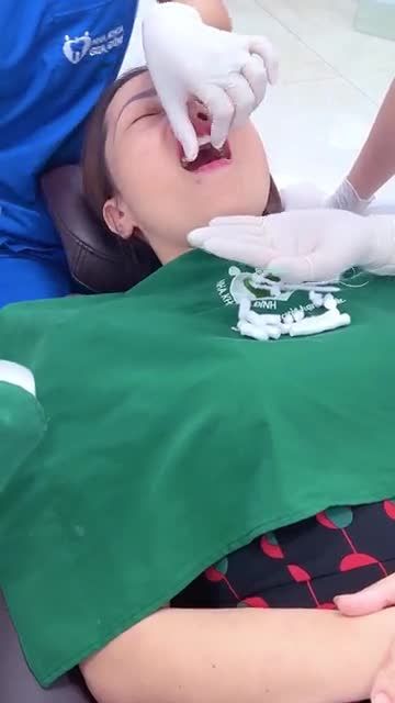 THẨM MỸ RĂNG SỨ CHO KHÁCH HÀNG ĐẾN TỪ PHÚ THỌ