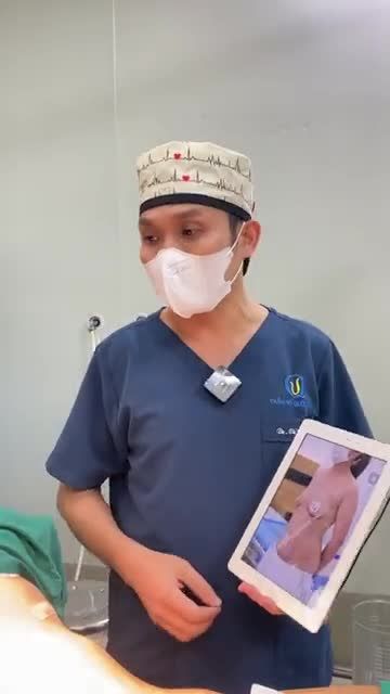 Kết quả sau quá trình Bác Sĩ Vũ Quang thực hiện Nâng Ngực và Hút Mỡ Tạo Hình Bụng cho khách hàng.