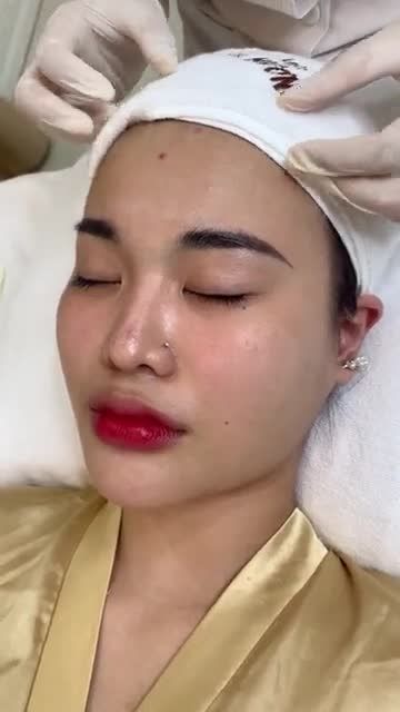 Đừng để làn da của bạn gặp phải quá nhiều vấn đề mới can thiệp