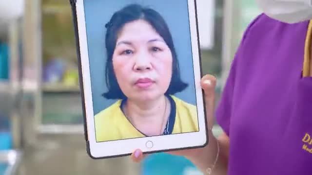 Combo Nâng cung mày + Cắt mí giúp khách hàng trẻ trung như thế nào? Theo dõi ngay