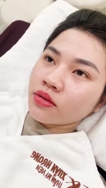 Môi phun sau 3 tháng sẽ có màu như thế nào?