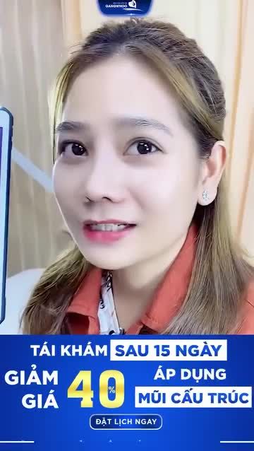 NÂNG MŨI CÔNG NGHỆ MỚI - 7 NGÀY LÀ ĐẸP
