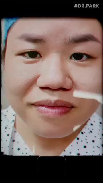 BẤM MÍ HÀN QUỐC - MẮT ĐẸP CHỈ TRONG 1 NỐT NHẠC