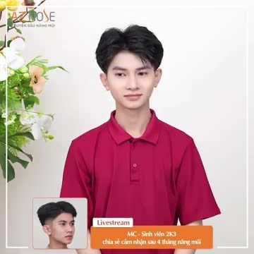 Cảm nhận sau 4 tháng nâng mũi của nam MC - Sinh viên 2K3 Dáng mũi do Bác sĩ CKI. Hoàng Nhung thực hiện.