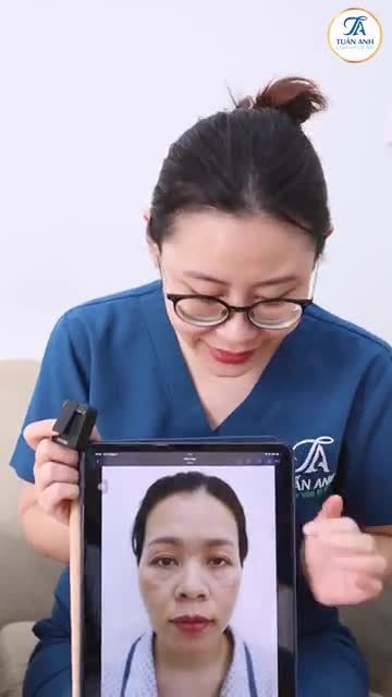 SAU CHỈ VỚI 1 THÁNG KHÁCH HÀNG QUAY TRỞ LẠI TÁI KHÁM TẠI THẨM MỸ TUẤN ANH