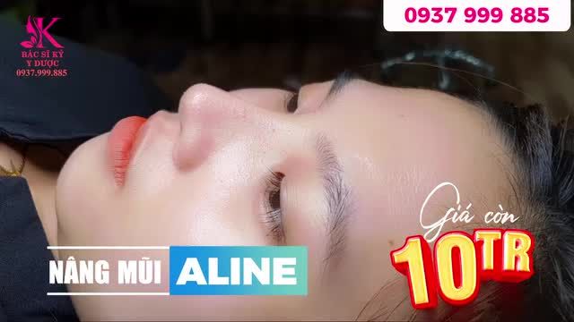 Sở hữu dáng mũi ALINE cao thanh tự nhiên cùng với 3 tiêu chí quan trọng