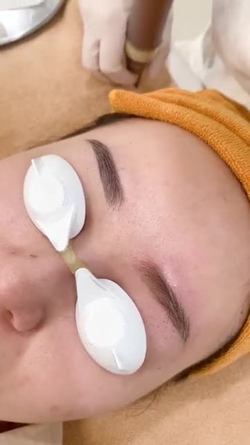 Hút mực xăm mày bị trổ xanh, đỏ
